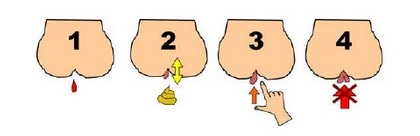 [Image: cac-cap-do-benh-tri.jpg]