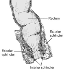 Các phương pháp điều trị bệnh trĩ