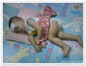 sot tieu chay
