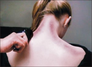 cách chữa táo bón