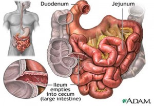 rối loạn tiêu hóa trẻ em