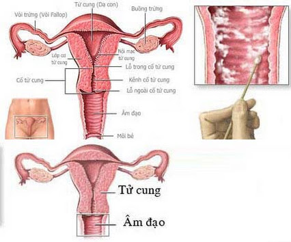 Các bộ phận sinh dục liên quan đến viêm nhiễm phụ khoa