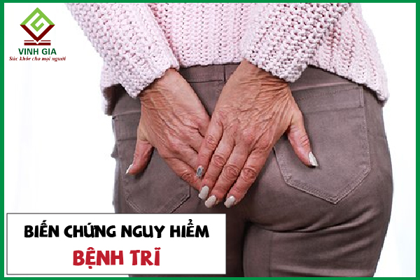 6 biến chứng nguy hiểm của bệnh trĩ người bệnh nên biết