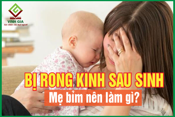 Rong kinh sau sinh và những điều mẹ bỉm sữa cần biết