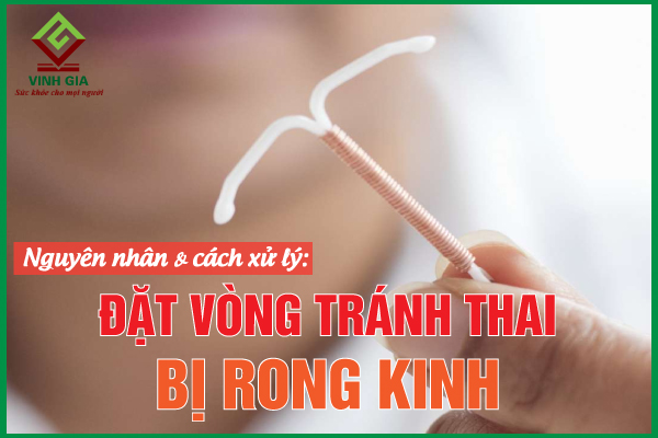 Đặt vòng tránh thai bị rong kinh phải xử lý ra sao?