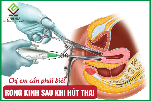 Rong kinh sau khi hút thai: Những nguy hiểm có thể gặp