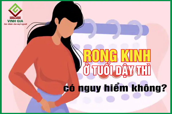 Rong kinh ở tuổi dậy thì và những vấn đề cần biết