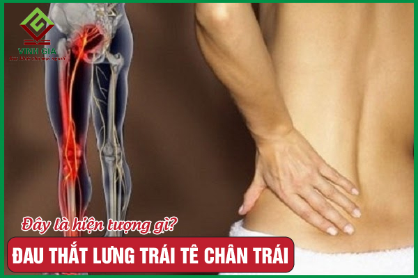Cảnh báo khi đau thắt lưng trái tê chân trái mà bạn không nên bỏ qua