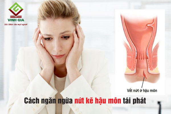 Để tránh tình trạng nứt kẽ hậu môn tái phát, cần chăm sóc đúng cách Để tránh tình trạng nứt kẽ hậu môn tái phát, cần chăm sóc đúng cách