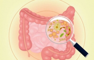 Tiêu chảy do rota virut nguyên nhân chính gây bệnh tiêu chảy cấp Tiêu chảy do rota virut nguyên nhân chính gây bệnh tiêu chảy cấp