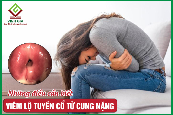 5 biểu hiện của viêm cổ tử cung nặng nên đi khám ngay