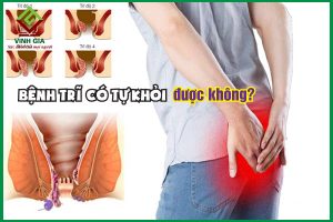 Bệnh trĩ có tự khỏi được không?