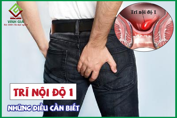 Bệnh trĩ nội độ 1: Điều trị không cần phẫu thuật