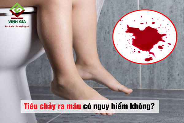 Bị tiêu chảy ra máu có nguy hiểm không?