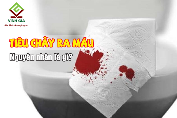 Bị tiêu chảy ra máu nguyên nhân là gì?