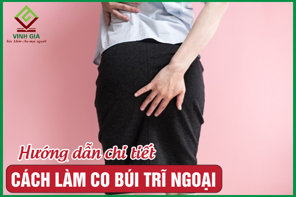 Cách làm co búi trĩ ngoại hiệu quả, an toàn nên áp dụng