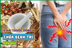 Chữa bệnh trĩ bằng đông y hiệu quả với 12 bài thuốc