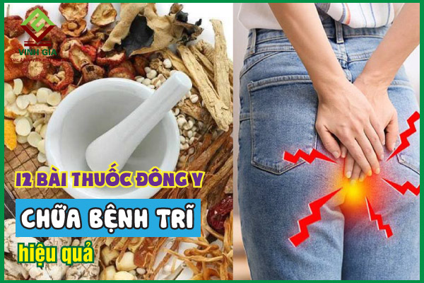 Cải thiện bệnh trĩ bằng đông y hiệu quả với 12 bài thuốc