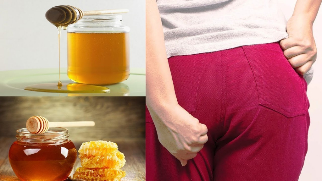 Mật ong và tác dụng to lớn trong điều trị trĩ tại nhà Mật ong và tác dụng to lớn trong điều trị trĩ tại nhà