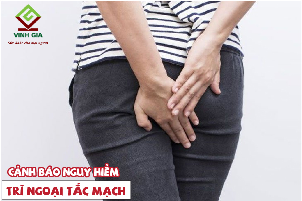 Trĩ ngoại tắc mạch có nguy hiểm không? Trĩ ngoại tắc mạch có nguy hiểm không?