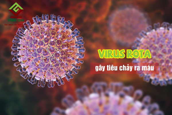 Virus Rota là nguyên nhân phổ biến gây tiêu chảy ra máu