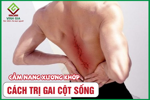 8 Cách cải thiện gai cột sống hiệu quả không phải ai cũng biết