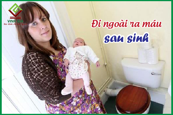 Sau sinh đi cầu ra máu nguy hiểm như thế nào?