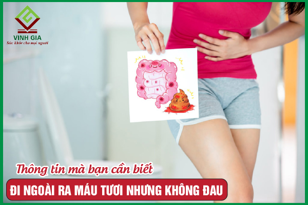 Đi ngoài ra máu tươi nhưng không đau có nguy hiểm không?