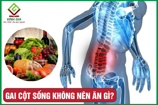 Bị gai cột sống không nên ăn gì? Những lưu ý về dinh dưỡng