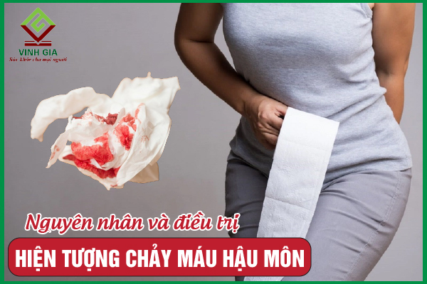 Chảy máu hậu môn: Dấu hiệu cảnh báo bệnh lý nguy hiểm