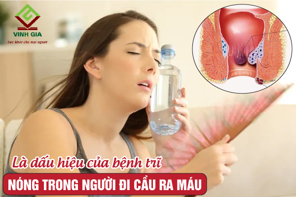 Nóng trong kèm theo hiện tượng đi ngoài ra máu là dấu hiệu của bệnh trĩ Nóng trong kèm theo hiện tượng đi ngoài ra máu là dấu hiệu của bệnh trĩ
