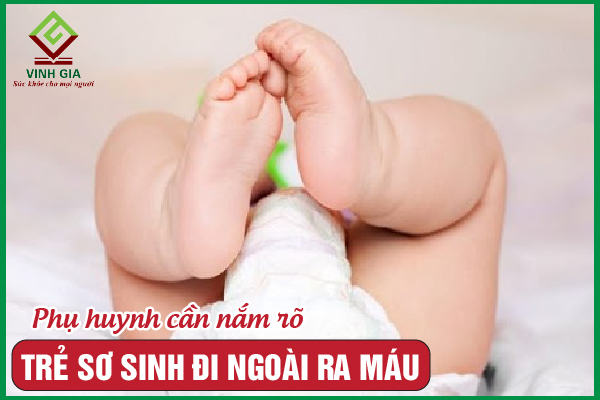 Trẻ sơ sinh đi ngoài ra máu: Phụ huynh nên giải quyết ra sao?
