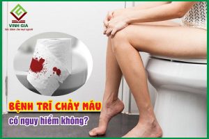 Bệnh trĩ chảy máu có nguy hiểm không?