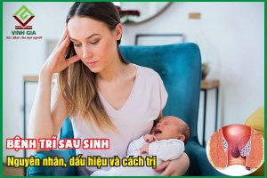 Bệnh trĩ sau sinh: Nguyên nhân, dấu hiệu và cách điều trị