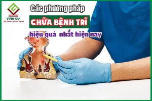 Các cách chữa bệnh trĩ hiệu quả nhất hiện nay