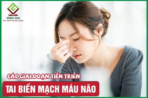 Các giai đoạn của tai biến mạch máu não ai cũng cần biết