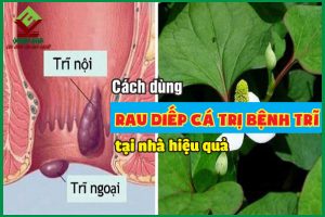 Cách dùng rau diếp cá trị bệnh trĩ tại nhà đơn giản mà hiệu quả