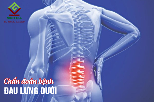 Chẩn đoán đau thắt lưng dưới bằng nhiều cách như chụp X-quang