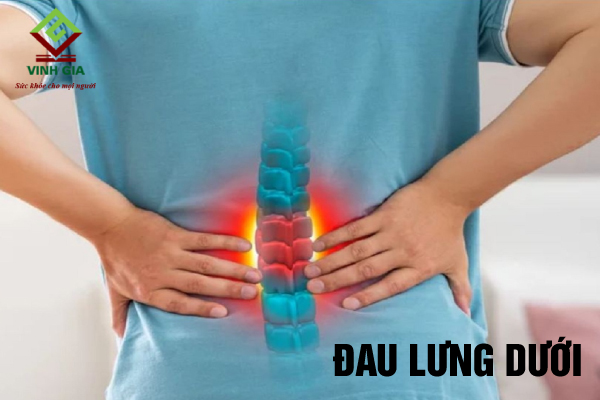 Đau lưng dưới là tình trạng các cơn đau xuất hiện tại vùng thắt lưng, mông