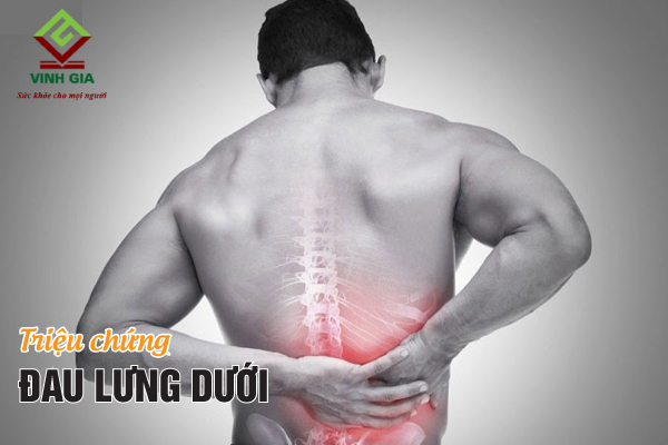 Đau lưng dưới thường đau mỏi âm ỉ tại thắt lưng rồi lan xuống hông