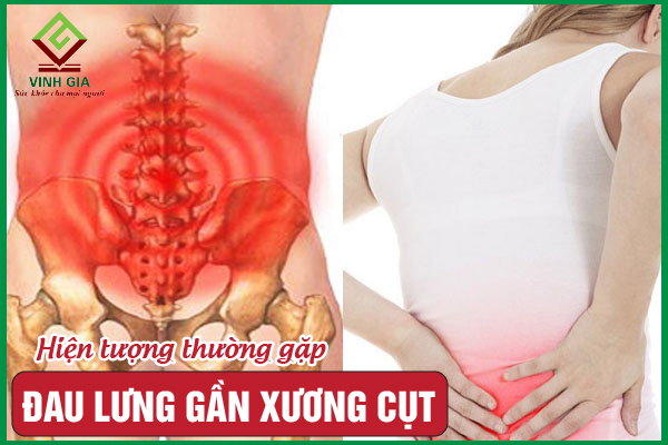 Nguyên nhân đau lưng gần xương cụt và cách cải thiện