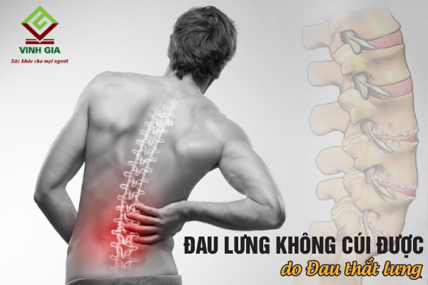 Đau thắt lưng khiến người bệnh gặp khó khăn khi cử động như đau khi cúi