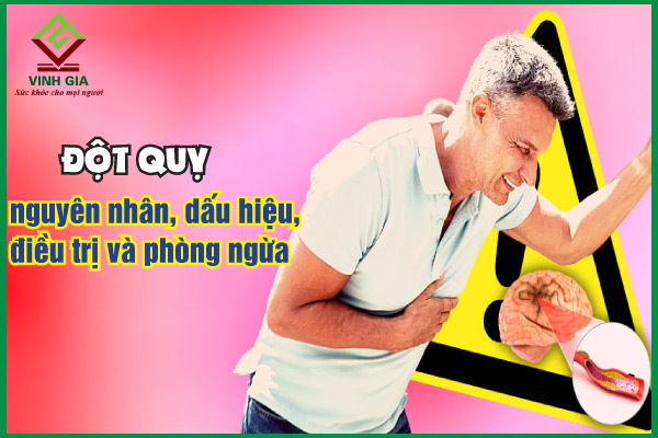 Đột quỵ: Nguyên nhân, dấu hiệu, cách khắc phục và phòng tránh