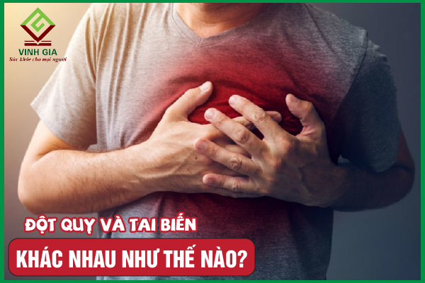 Đột quỵ và tai biến mạch máu não có phải là một không?