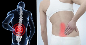 Đứng lâu bị đau lưng là bệnh gì? Có nguy hiểm không? Đứng lâu bị đau lưng là bệnh gì? Có nguy hiểm không?