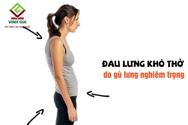 Khi cột sống bị cong vẹo sẽ gây áp lực lên phổi dẫn tới khó thở đau lưng