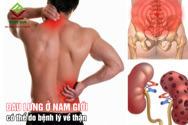 Nếu mắc bệnh về thận sẽ gây ra đau lưng ở nam giới Nếu mắc bệnh về thận sẽ gây ra đau lưng ở nam giới