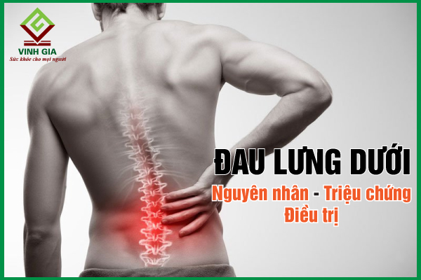 Đau lưng dưới: Nguyên nhân, triệu chứng và khắc phục