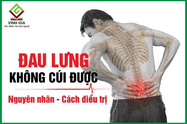 Đau lưng không cúi được: Nguyên nhân và cách khắc phục