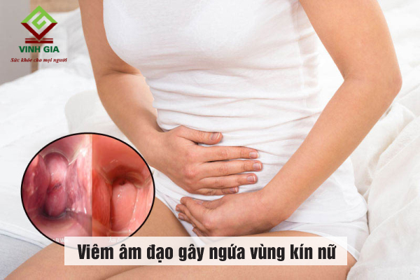 Nguyên nhân gây ngứa vùng kín nữ - Viêm âm đạo Nguyên nhân gây ngứa vùng kín nữ - Viêm âm đạo